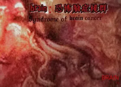 brain：恐怖脑症候群
